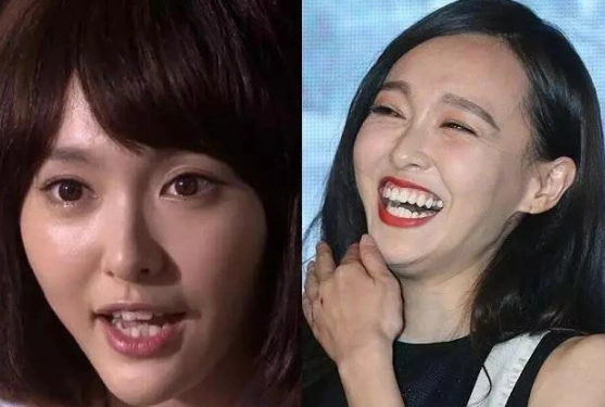 "整牙"如换头的5位女星:杨幂变瓜子脸,baby气质突变