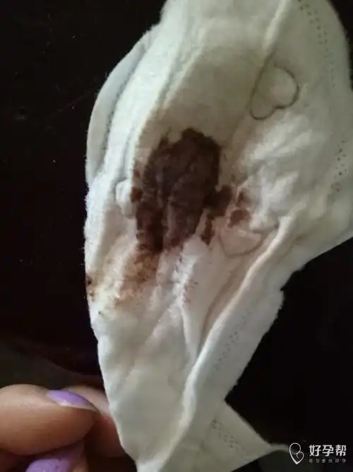 不知道怎么回事 31来的月经 15号又来一种脏兮兮的东西 又不的