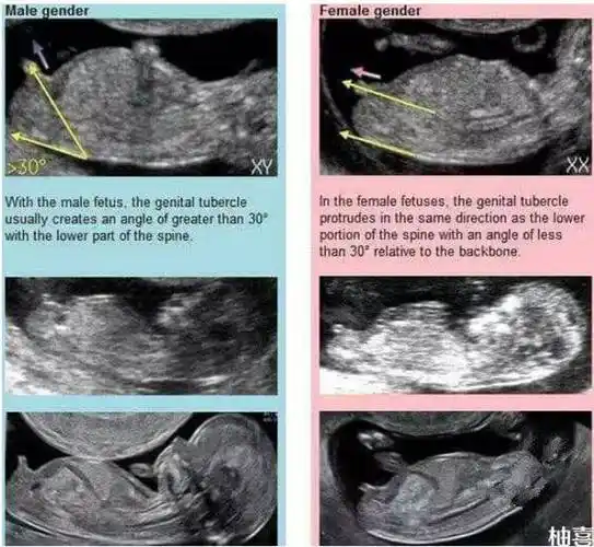 看男女,nub(nub theory)是英国开始流传起来的,nub就是胎儿的生殖节