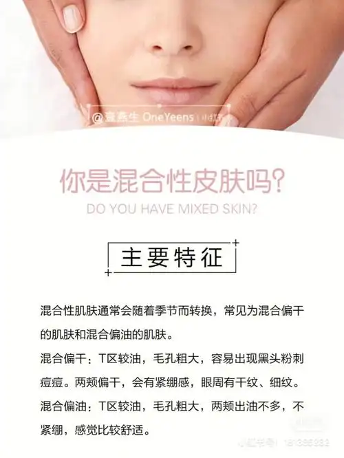 混合性皮肤