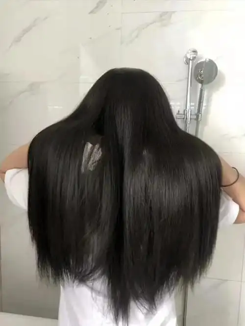 上大学以后突然掉头发很严重应该怎么办