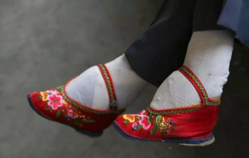 将拇趾以外的四个脚趾连同脚掌折断弯向脚心,形成"笋"形的"三寸金莲"