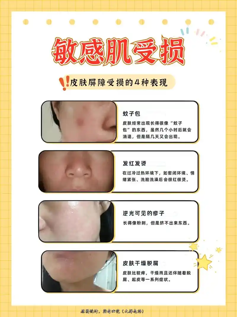 屏障受损的466种表现,一张图教你自检!|||除了长痘皮肤屏障 - 抖音