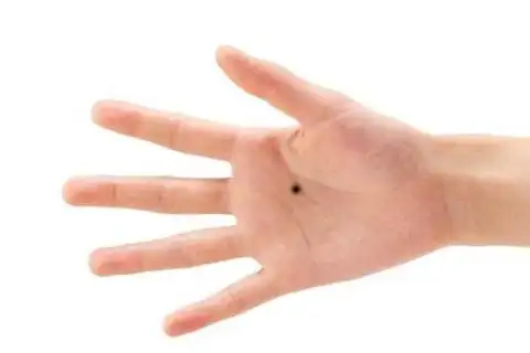 女人右手痣相图解大全