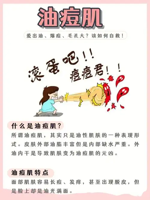 油痘肌爱出油爆痘毛孔大71该如何自救