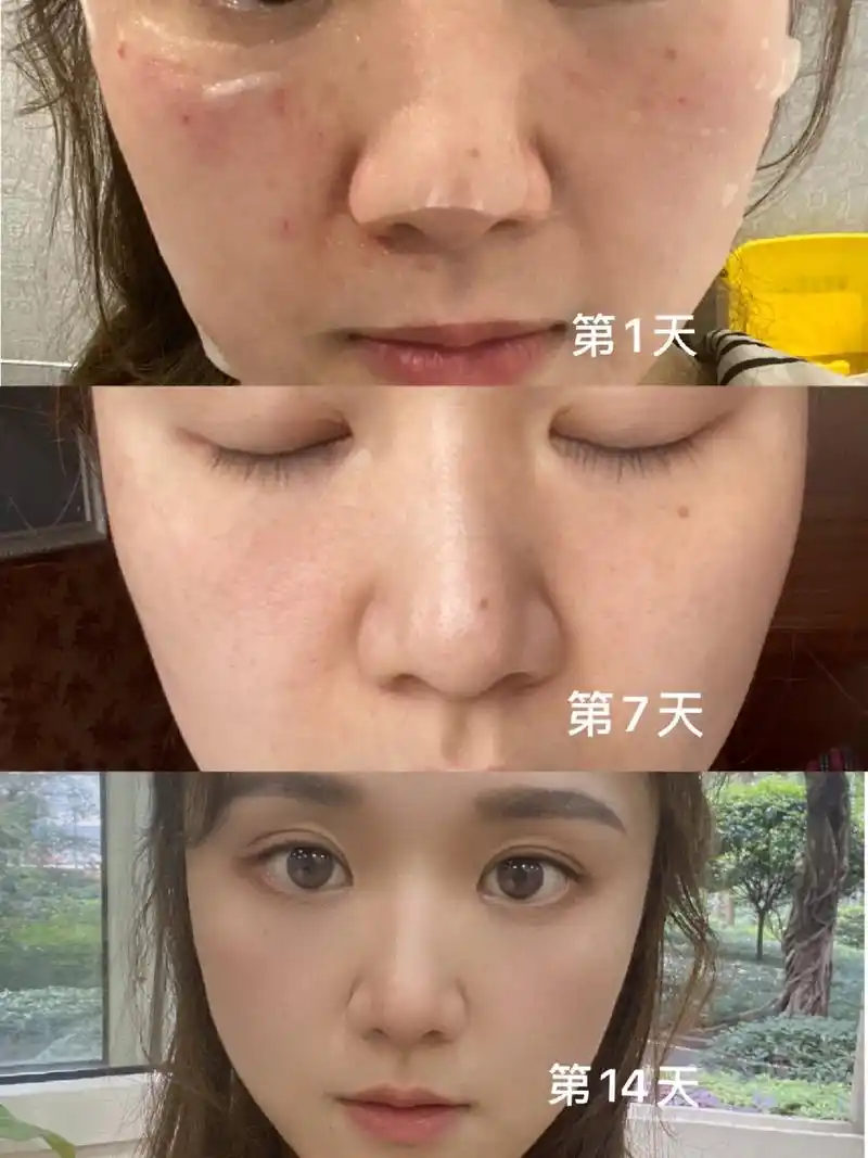 新氧试用官韩佳人三文鱼微水光