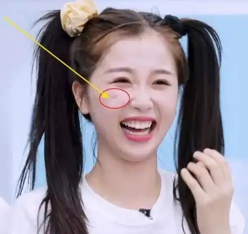 虞书欣力证自己没整容直接用手捏脸扮鬼脸看到效果网友炸锅