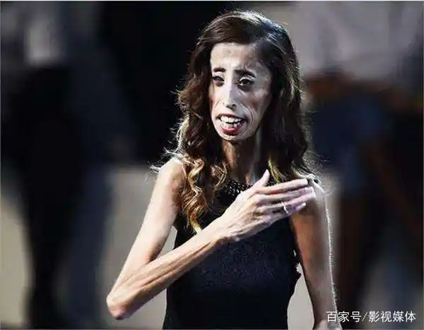 57米,全身上下皮包骨