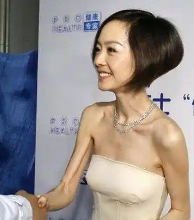 瘦得像纸片人,这样的美宁可不要_体重_杨颖_王子