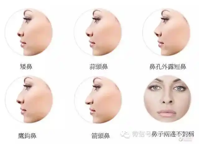 高鼻梁不等于好看的鼻子哦