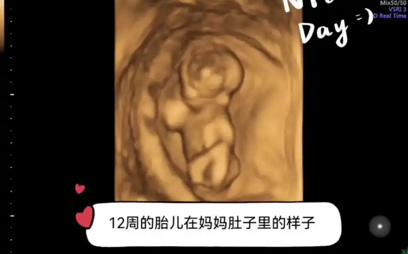 12周的胎儿在妈妈肚子里的可爱瞬间