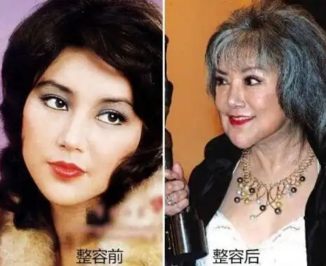 【图】香港艳星邵音音整容失败 下巴错位险些毁容_港台星闻_明星-超级