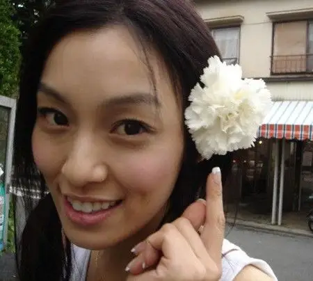 图范玮琪整容前后照片对比脱发真相曝光信息量很大