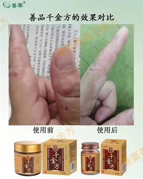 遇见善业千金方,皮肤问题不用慌. - 抖音