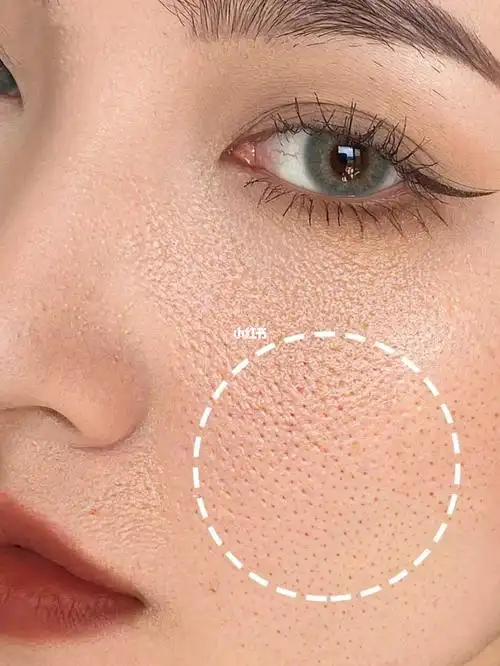 朋友我爱上了收缩毛孔