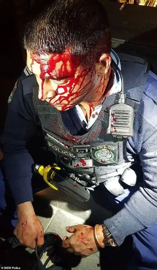 悉尼cbd警察遭人持刀砍头!鲜血直流!路人都吓傻了