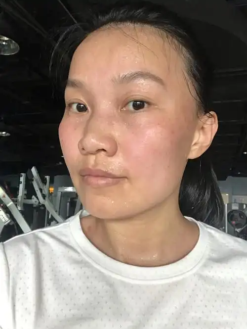 素颜的斑点太吓人了