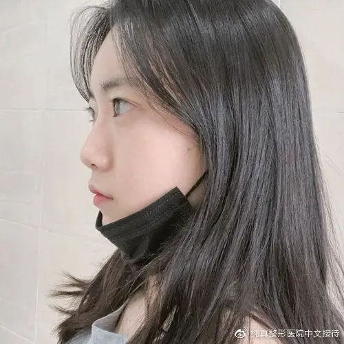 曾经蒜头鼻 塌鼻梁的她,纯真崔宰源做完隆鼻后秒变可甜可盐的颜神!