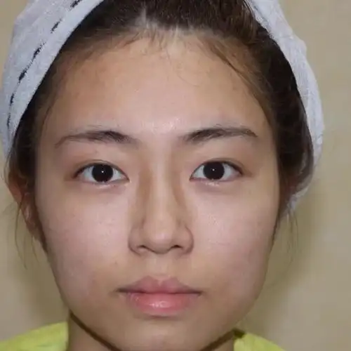 我的皮肤状况:肤色不均 黄气重 稍微有点斑和痘印