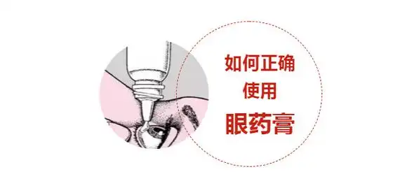 如何正确使用眼药膏_余威德_副主任医师_爱问健康