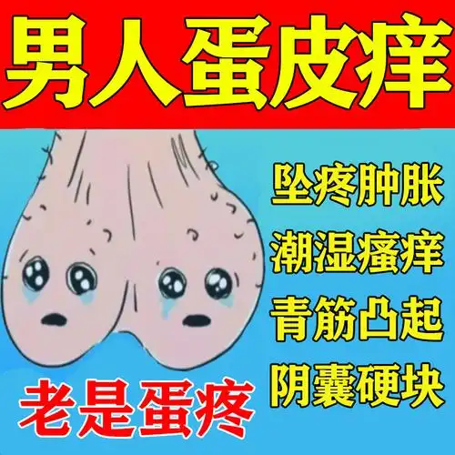 湿疹止痒藓瘙痒阴囊私处男