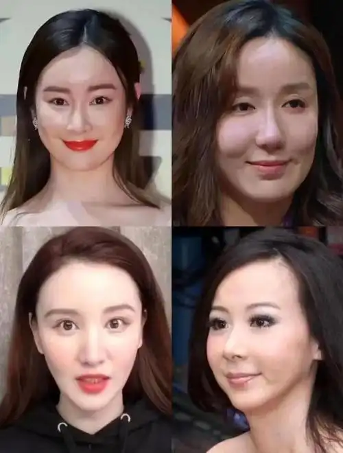 娱乐圈毫无预兆突然变脸的明星,眼睛变小鼻子变窄,越看越不对劲|倪妮