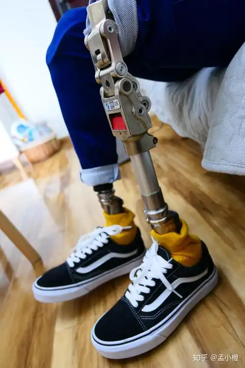 主动露出腿部假肢上街是种怎样的体验