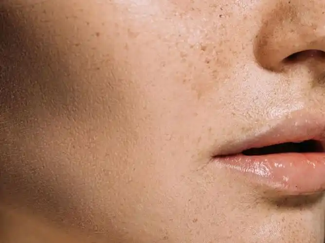 脸色暗黄,没有其它身体不适,做好这4点帮你缓解脸色暗沉_医联媒体