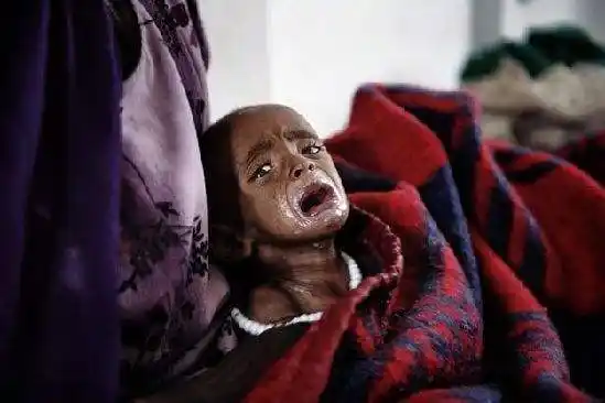 的饥饿正导致每个月1万名儿童死亡,其中50%在撒哈拉以南的非洲地区