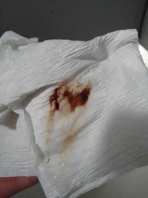 排卵期前俩天和老公同房了这些天出血了是深褐色的这是怎么了?