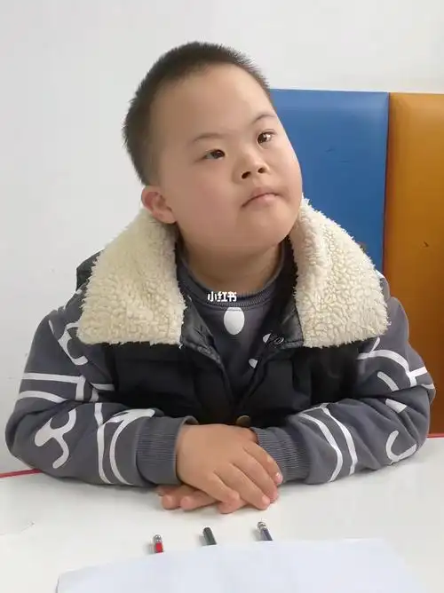 特殊儿童  #特殊教育  #发育迟缓  #唐氏综合征