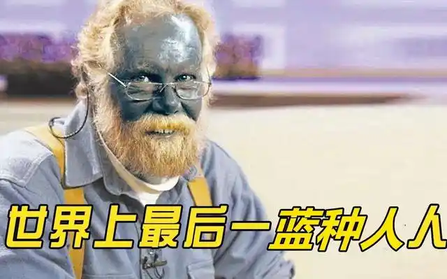 世界上绿种人人口仅剩3000不用吃饭靠晒太阳就能存活