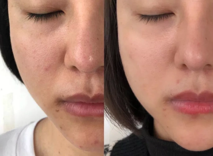 这是我年前和现在的对比图,是不是感觉不可置信?