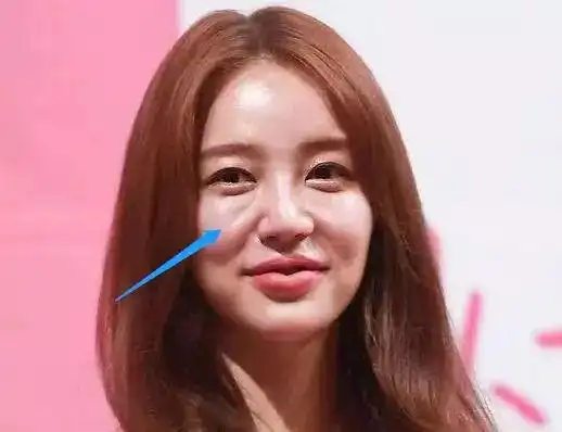 昆凌这个部位的问题,让她笑起来像哭!_颧骨