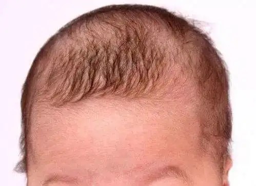 宝宝的头发又黄又稀缺锌缺铁家长不知原因竟然是这样