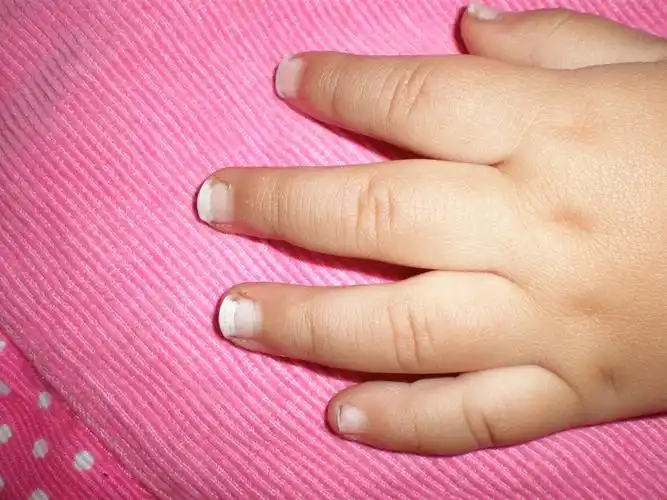 长出的指甲是白色的