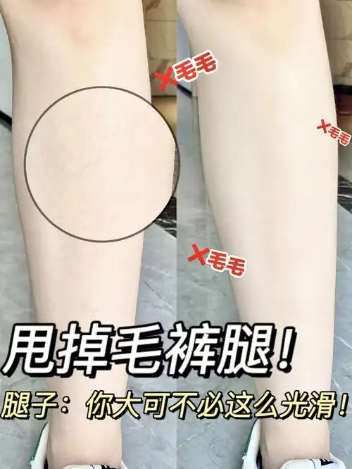 长毛人集合这支脱毛膏是认真的