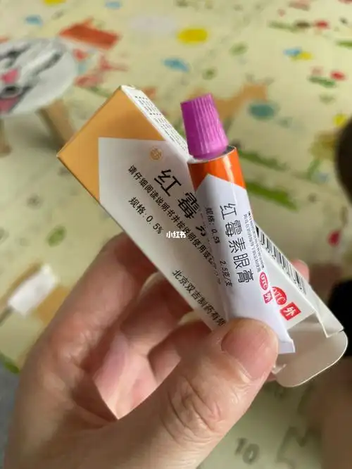红霉素眼膏除了治疗眼睛还能
