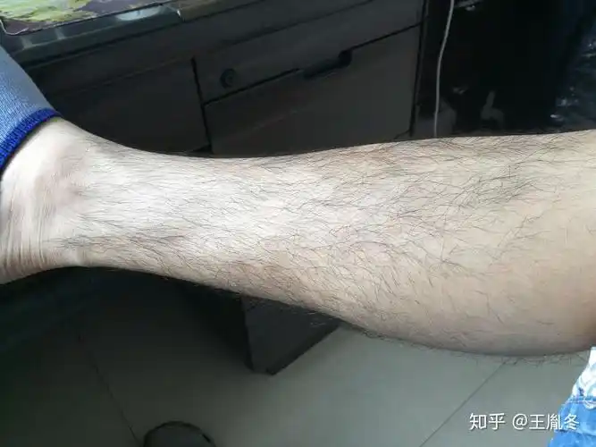 腿毛茂盛的男生夏天应该刮腿毛吗? - 知乎
