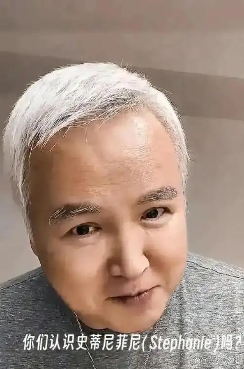 63岁林瑞阳近况:白头发白眉毛白脸蛋,容貌怪异,号召去国外发财