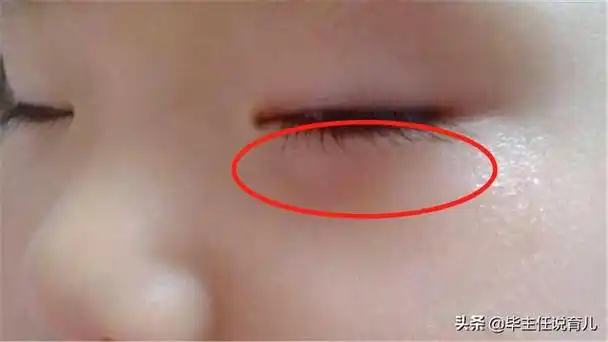 头条问答 - 孩子身体哪3处"变色",体现孩子积食,脾胃不好了?(1个回答)