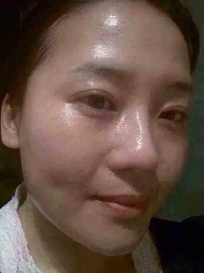 (女生皮肤粗糙问题调理)-52线报网