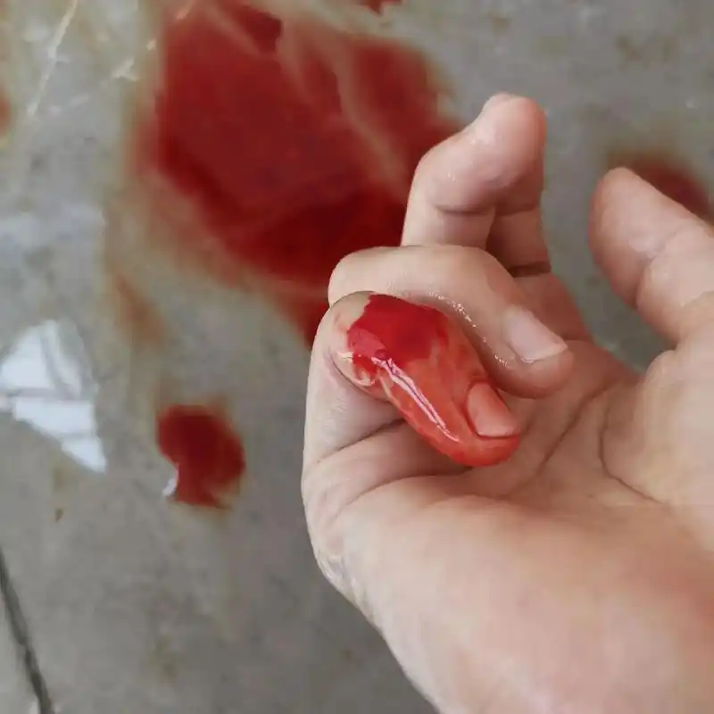 手在流血心在滴血,看着血流不止的那一刻,我没有有矫情,有痛自 - 抖音