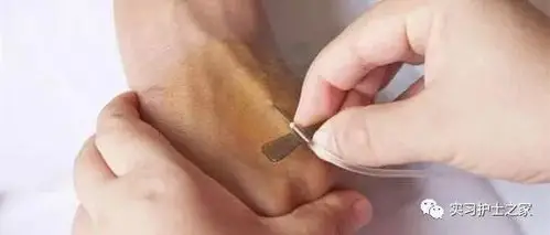 穿刺法:绷紧上下皮肤,固定血管后行旁刺.部位:手腕部及足踝腕部.