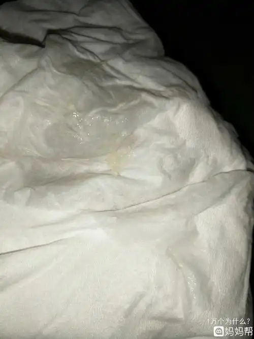 根据你的叙述出现白带拉丝状考虑是排卵期,在排卵期会出现白带的增多