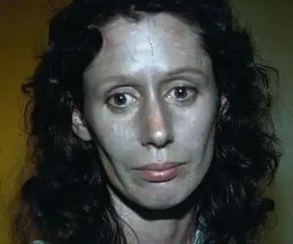 我们黄种人以微黄的肤色最为常见,脸色有些暗沉也实属正常;有些人