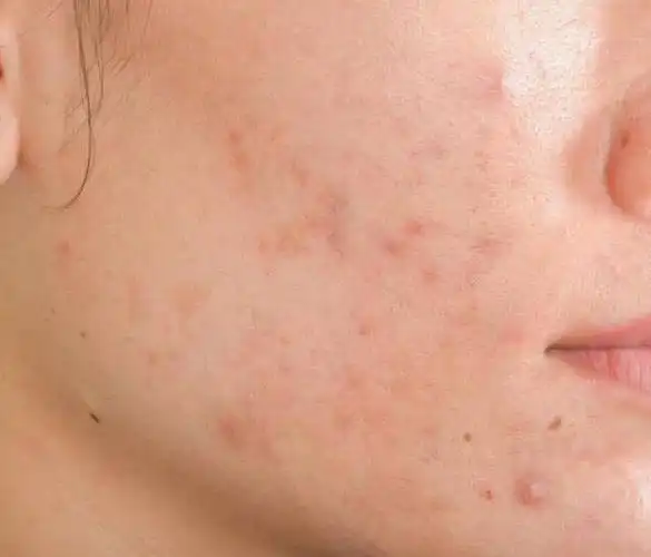 它们在咱们的床铺里安营扎寨,影响呼吸,瘙痒皮肤,搅得人夜不安枕.