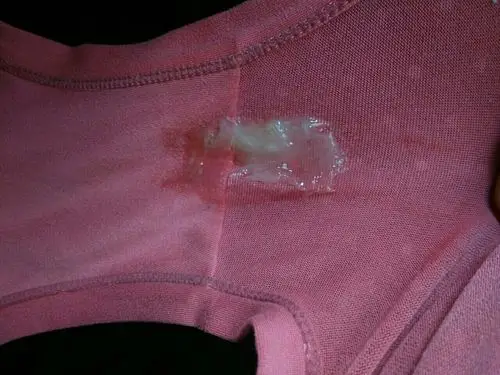 2016-06-26 17:00    浏览  33333  推荐回答 你好,这个现在是白带