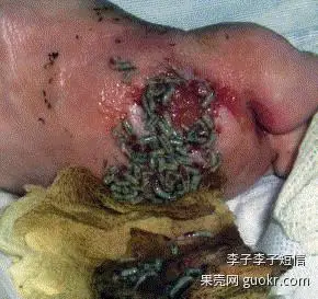 展开全部 2011年12月22日,法国研究人员表示,蛆虫清理难以愈合的大型