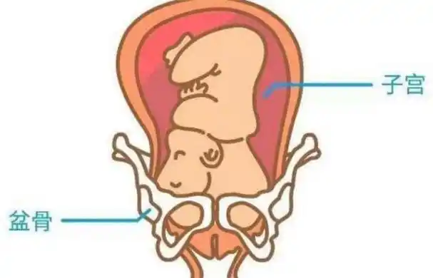 01胎儿入盆的几个疑问